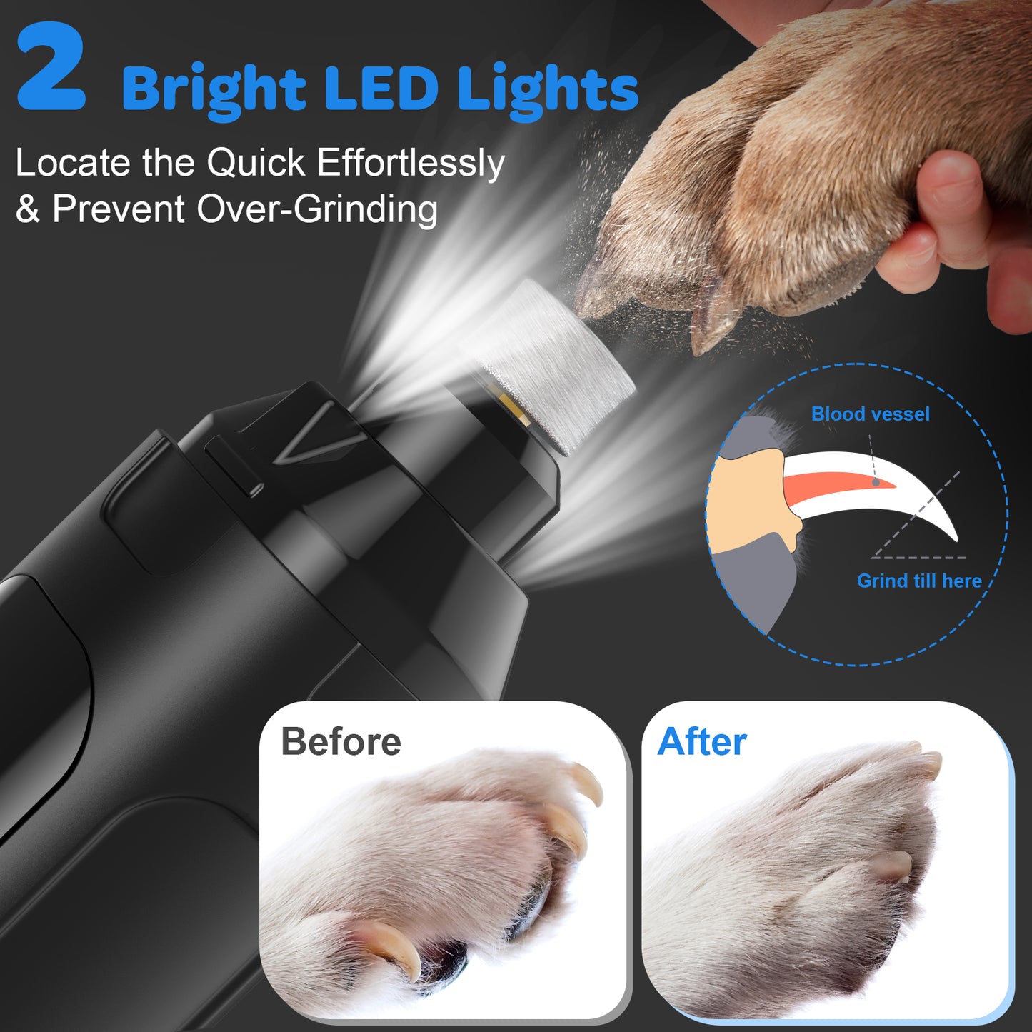 LAKWAR 6-Speed Dog Nail Grinder - Upgraded Pet Nail Grinder Super Quiet Rechargeable Electric Dog Nail Trimmer Painless Paws Grooming & Smoothing Tool for Large Medium Small Dogs(Gray)